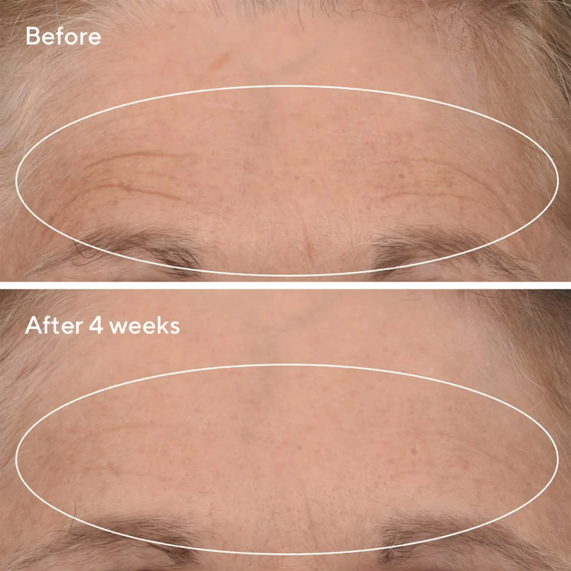 Murad The Science of Healthy Skin: Lift   ReSculpt With Retinal
